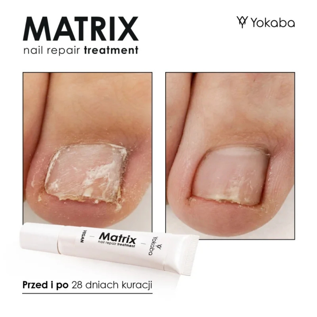 Yokaba Matrix Nail Repair Treatment 15ml