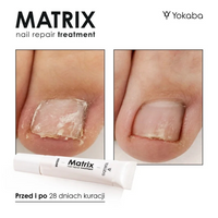Yokaba Matrix Nail Repair Treatment 15ml