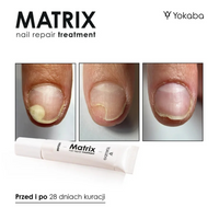 Yokaba Matrix Nail Repair Treatment 15ml